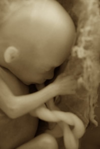 Unborn baby
