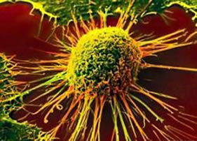 cancer cell